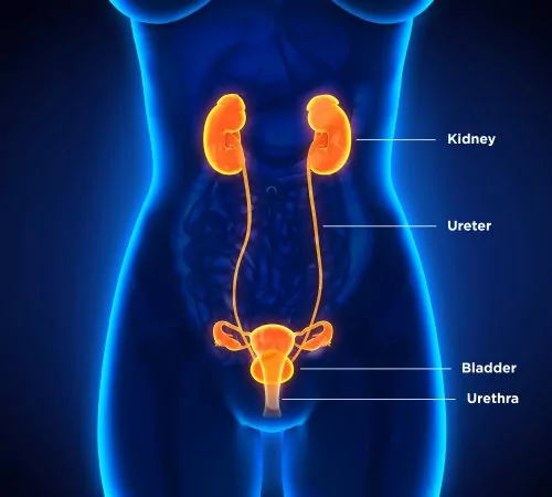 how-and-where-kidney-stones-occur-dornier-medtech