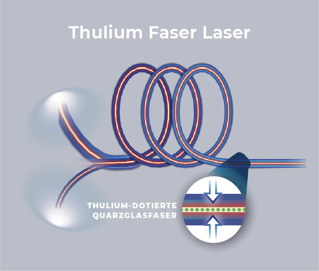 Fiber Laser Thulium De